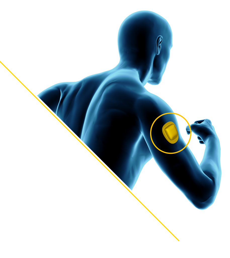 wearable-drug-delivery